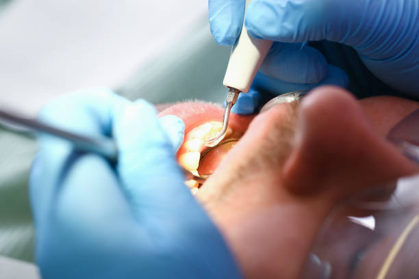 Best Emergency Treatment for Toothache in Cedar Hill, MO