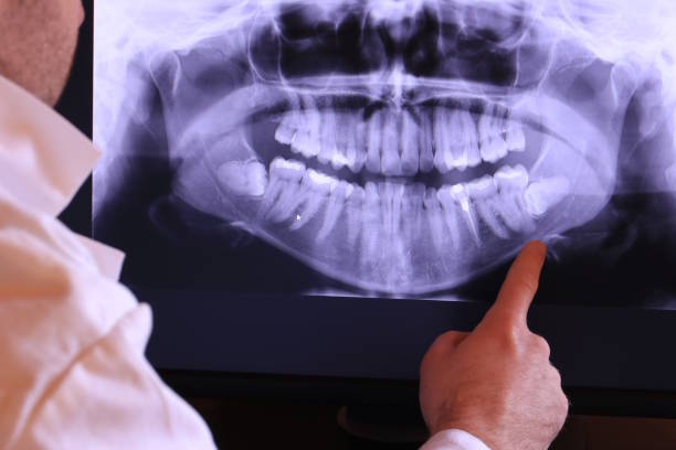 Best Emergency Treatment for Toothache in Cedar Hill, MO